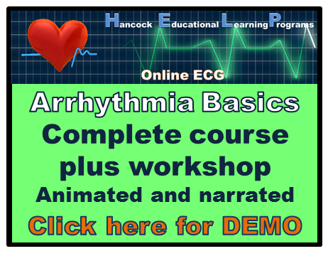 Basic arrhythmia ekg ecg online course